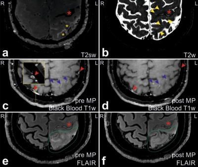 Erfolgreiche immunmodulatorische Behandlung